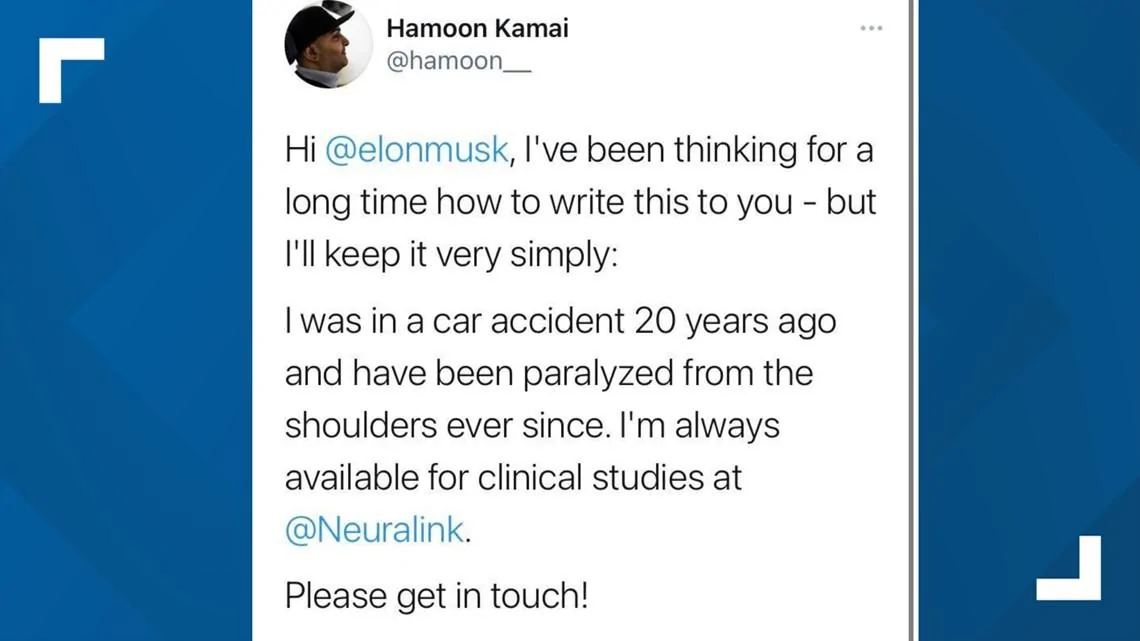 Tesla Cybertruck Elon Musk says Neuralink could start human trials by the end of the year 667fad2d-e0bc-49a7-a43d-3744e681af4d_1140x641
