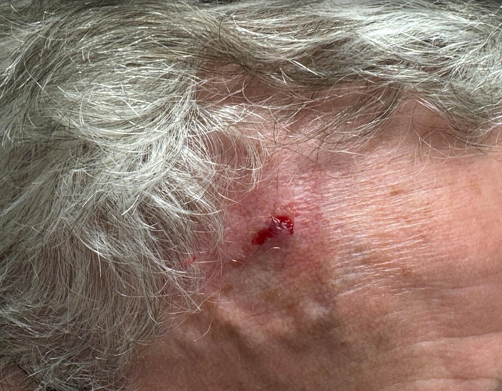 Tesla Cybertruck Potential injury warning: Leg cut by door corner (warning: graphic image) CT frunk lid injury